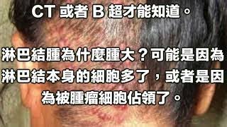 身上摸到硬塊, 到底是腫瘤癌變還是囊腫 以防萬一趕緊看一下!
