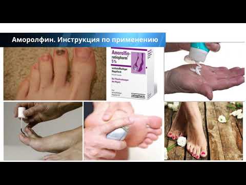Аморолфин от грибка ногтей - инструкция по применению, цена, отзывы, аналоги препарата