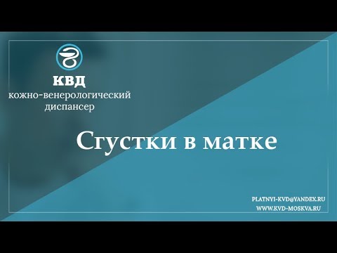 769  Сгустки в матке