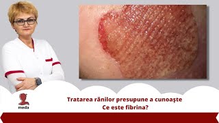 Tratarea ranilor presupune a cunoaste 👉 Ce este fibrina?