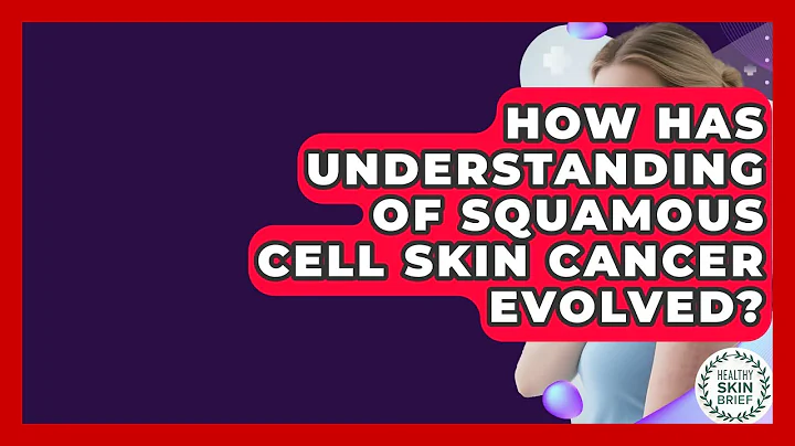 How Has Understanding Of Squamous Cell Skin Cancer Evolved? - Healthy Skin Brief