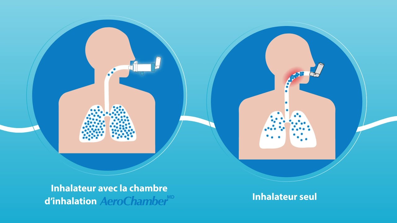 Chambre d'Inhalation AéroSpire Enfant – Aéroplast