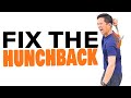 How to Fix Bad Posture: Fix Your Hunchback