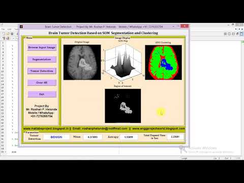 Matlab Code for Brain Tumor Detection Using Image Processsing