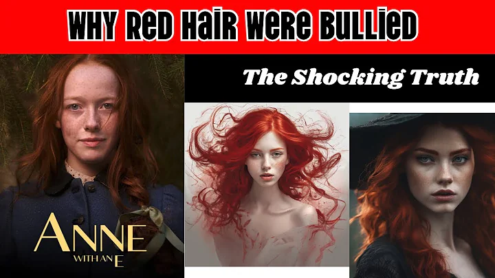 THE SHOCKING TRUTH: Why Red Hair Were Bullied  #redhair