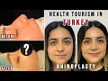 Rhinoplasty in Turkey - FULL EXPERIENCE | Affordable and Good Quality (HEALTH TOURISM IN TURKEY)