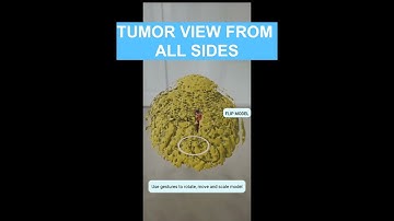 3D DICOM Viewer(Augmented Reality View and Admin Panel)