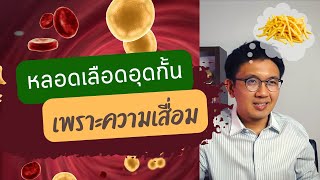 หลอดเลือดอุดกั้น เพราะ ร่างกายเสื่อมถอย - หมอนัท Live