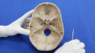 Interior Of Cranial Vault And Anterior Cranial Fossa