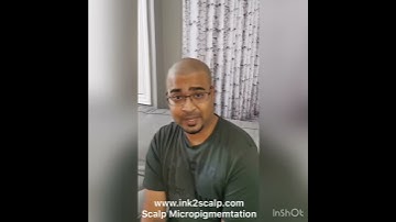 Watch this before your Scalp Micropigmentation Treatment | Ink 2 Scalp | Ontario