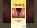 ENT Laryngoscopy Spotter #neetpg #pgentranceexam #theentresident
