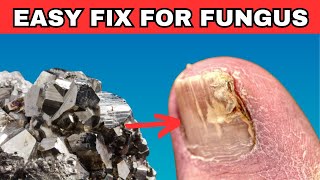 This Rare Mineral Cures Toenail Fungus