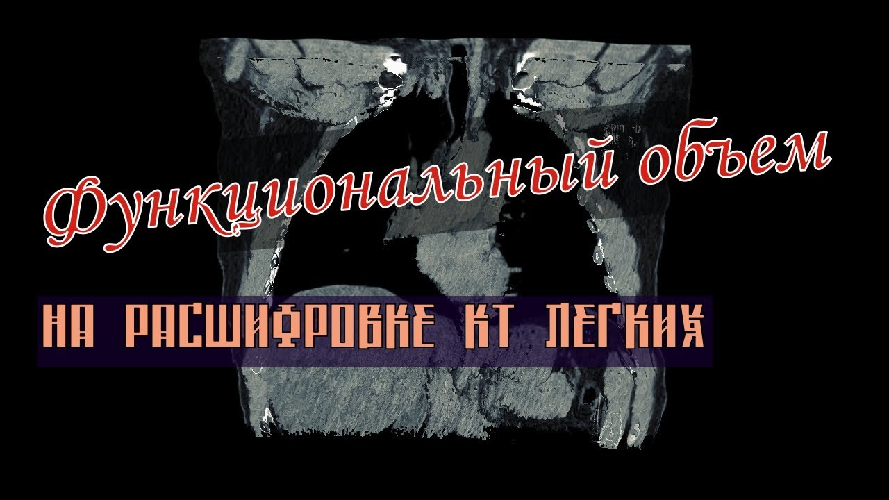 Высокое стояние купола диафрагмы с УМЕНЬШЕНИЕМ ОБЪЕМА ЛЕГКИХ на РАСШИФРОВКЕ КТ грудной клетки