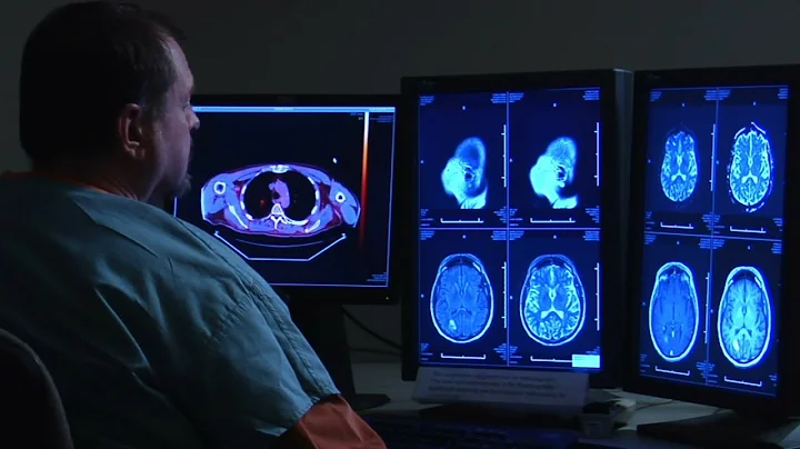 Studying how to monitor and treat TBI