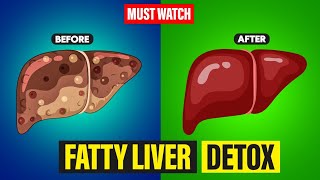 How To do Liver Detox at Home: 8 Ways to Detox your liver at Home