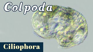 Colpoda (Ciliophora or Ciliate)