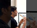 Running करने से घुटने घिस जाते हैं? Adipocyte Stem Cell Injection की पूरी जानकारी ! #shortvideo