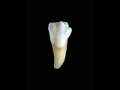 Anatomia do primeiro pr molar inferior 44 1pmi
