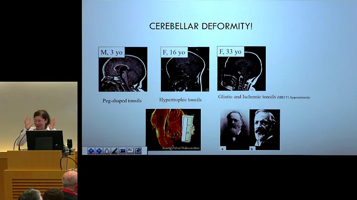 "Cerebrospinal Fluid Pathologies" - Petra M. Kling...