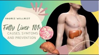 Fatty Liver 101: Uncover Symptoms, Types, Diagnosis, Treatment & Prevention Strategies! 🌟 by Krones WellNest 1,291 views 4 months ago 8 minutes, 58 seconds