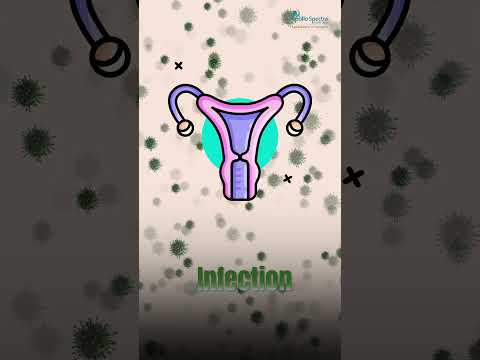 Vaginal Dryness: A Common Issue Women Shouldn't Ignore_by Dr  Pratima Poddar