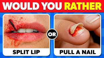 Would You Rather...? 😱 The Hardest Choices! 🔥✅ EXTREME Edition!