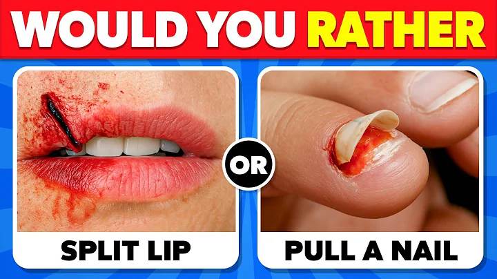 Would You Rather...? 😱 The Hardest Choices! 🔥✅ EXTREME Edition!