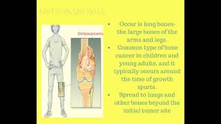 Pediatric soft tissue tumors:Sarcoma screenshot 3