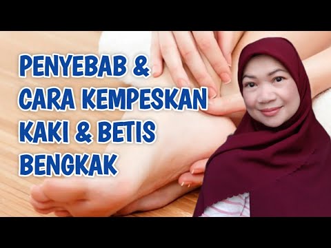 PENYEBAB KAKI BETIS BENGKAK & CARA MENGATASI KAKI BETIS YANG BENGKAK