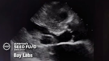 AI helps medical professionals interpret, perform ultrasounds – Bay Labs