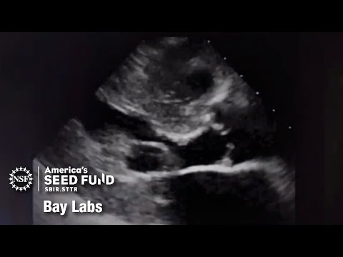 Diagnostic Lab Near Me For Ultrasound