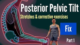 Posterior pelvic tilt | Posterior Pelvic tilt stretches & corrective exercises