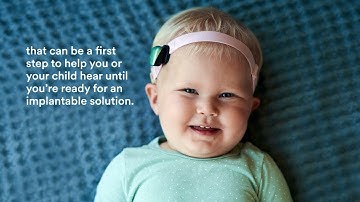 Cochlear™ Baha® Start | Cochlear Americas