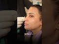 Why Your Botox Should Be Invisible | Dr. Amit Luthra | Amolik Aesthetics Vasant Vihar Delhi