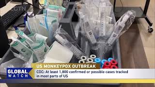 US MONKEYPOX OUTBREAK: Health officials warn more new cases expected through August