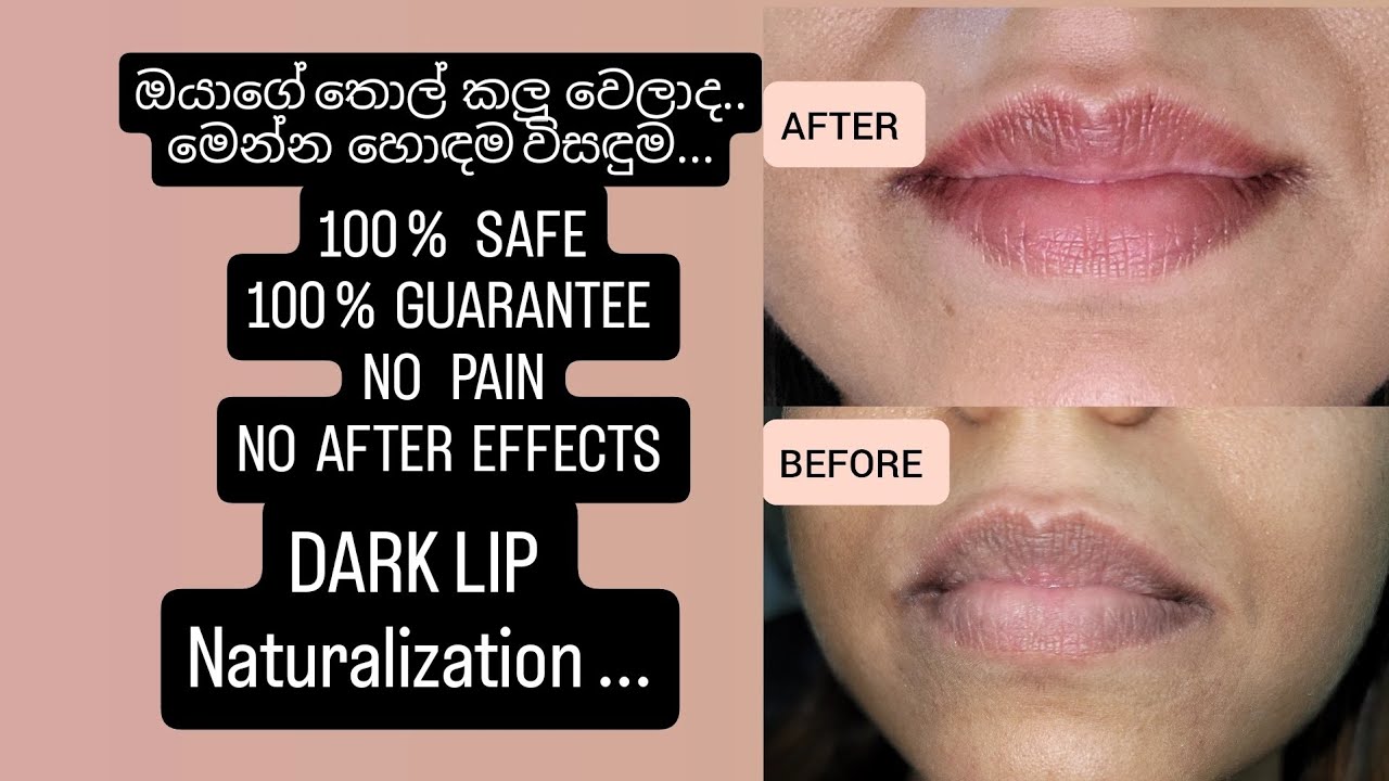 LIP BLUSH TREATMENT..ORANGE PLUS BEAUTY CLINIQUE, NUGEGODA 074 0025440, 0112 853924