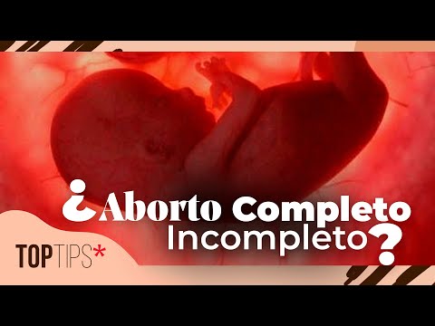 Video: Cómo identificar las píldoras: 11 pasos (con imágenes)