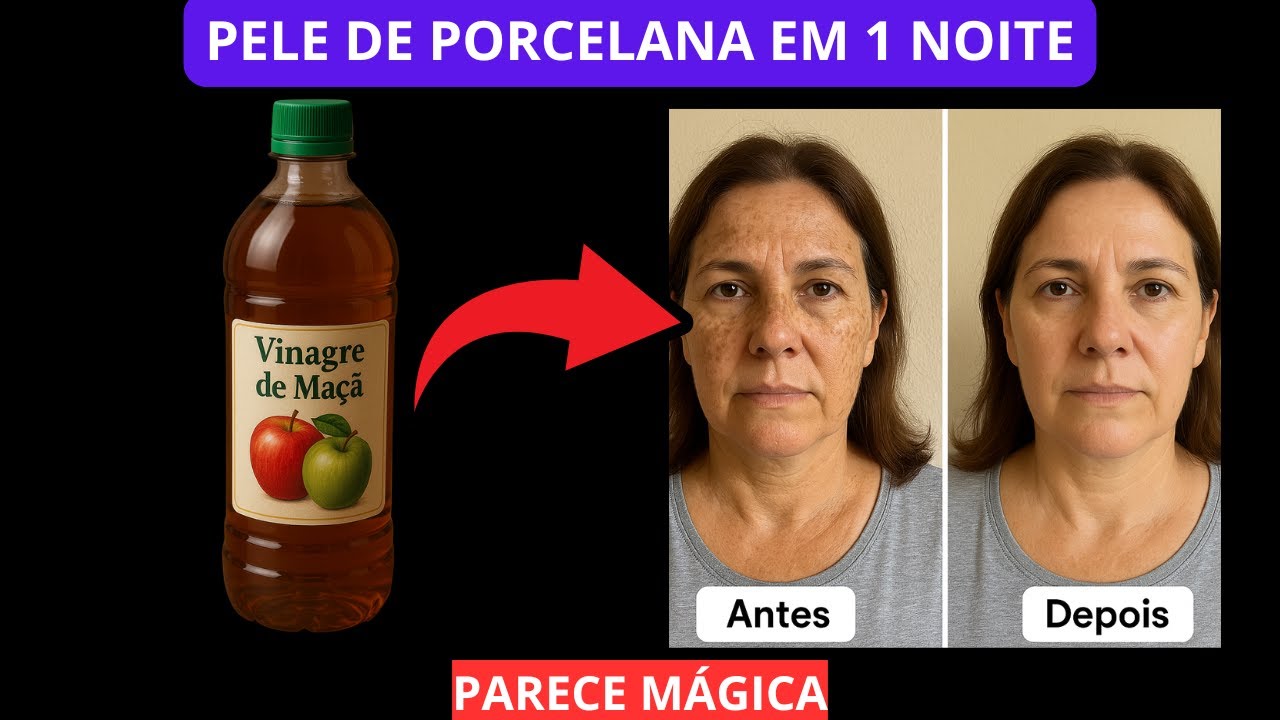 1 COLHER DE VINAGRE DE MAÇÃ ANTES DORMIR - ADEUS MANCHAS E PÉS DE ...