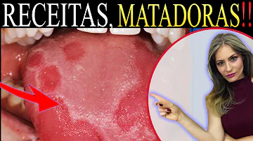 Qual a diferença entre candidíase é candidíase vaginal?