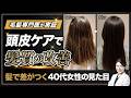 【40代女性必見】髪が老けると見た目年齢も上がる？髪の老化サインと頭皮ケアを解説