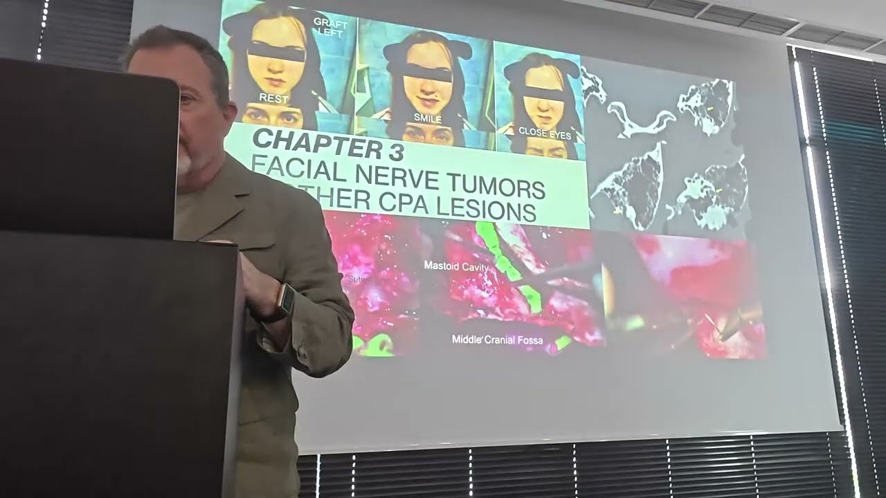 Facial Nerve Reconstruction | Pediatric Otolaryngology Kongres Łódź Poland 2025