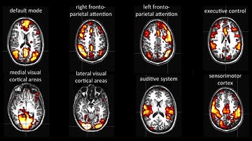 Resting-State Functional Connectivity in AFNI