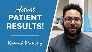 A Dentist Who Can Help With Tmj Pain Watch This Tmd Testimonial