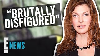 Linda Evangelista Says Cryolipolysis "Permanently Disfigured" Her | E! News
