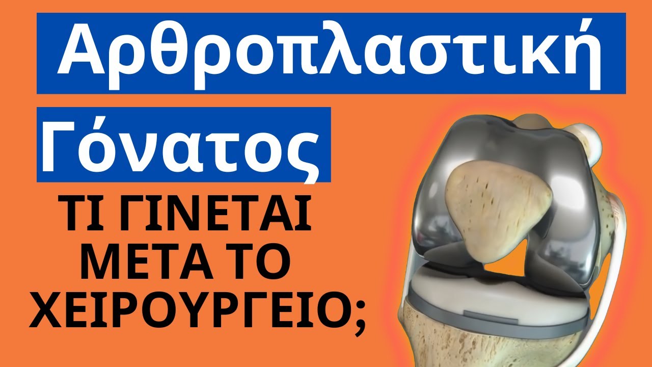 Ολική Αρθροπλαστική Γόνατος: Τι γίνεται μετά το χειρουργείο; #orthopaidikos