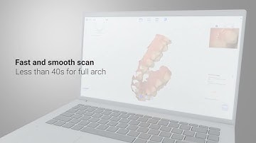 BLZ Dental INO200 Intraoral Scanner Introduction