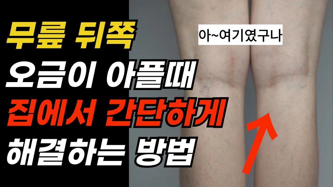 오금 통증 해결 방법! 무릎 뻑뻑함, 무릎 통증 마사지 - YouTube
