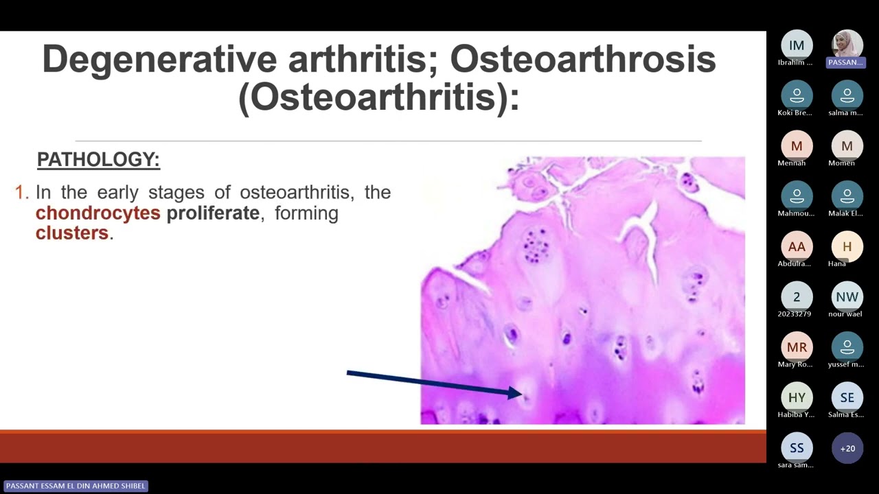 Bone 3 Pathology of joints