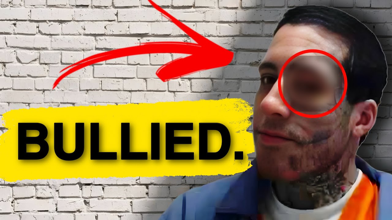 Wade Wilson Got BEAT UP In Prison! (Photo Proof)