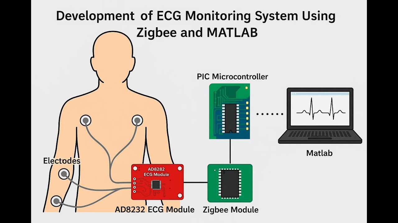 Development of ECG Monitoring system Using Zigbee and MATLAB